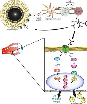 Stimulatory Thyrotropin Receptor Antibodies Are a Biomarker for Graves’ Orbitopathy